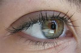 gözde ağrının nedeni nedir gözümün etrafı ağrıyor neden olabilir gözün çevresindeki ağrıların nedenleri nelerdir