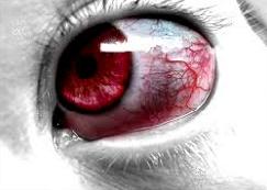 göz ağrısı için tavsiyeler nelerdir göz ağrısı nasıl geçer göz ağrısına ne iyi gelir göz ağrısının tedavisi