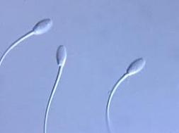 sperm üretimi sperm nasıl üretilir