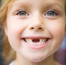 dişlerdeki çürüklerin önüne nasıl geçeriz, diş çürümesi nasıl engellenir
